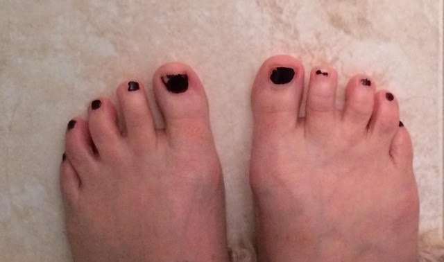 chipped, peeling toenail polish